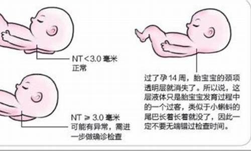 大排畸和四维的区别是什么_大排畸和四维的区别是什么,怎么看男宝女宝